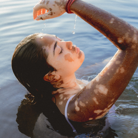Sensitive Skin – How to Care for It Gently